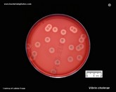 vibrio cholerae colony appearance